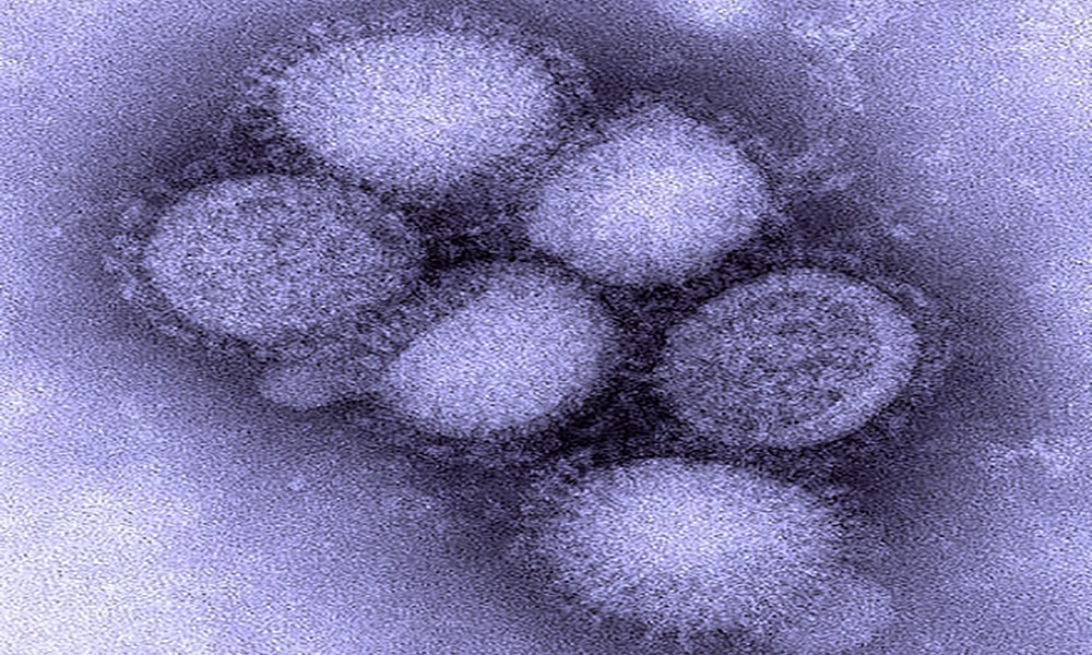 influenza suina